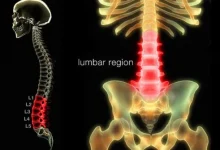 low back pain s1 illustration lumbar spine